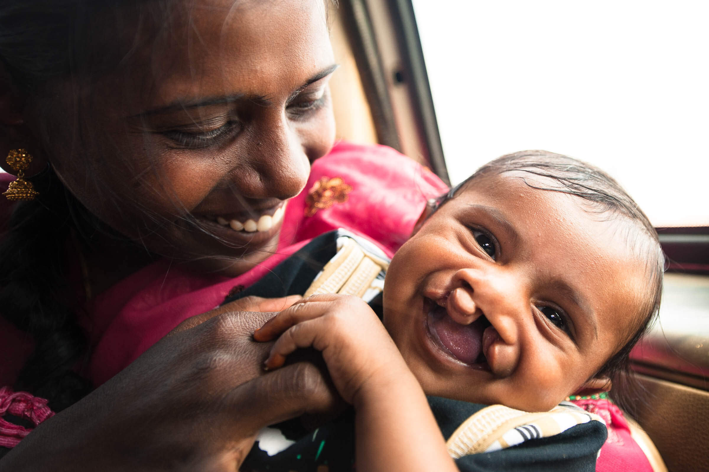 Cleft Kind Indien 101