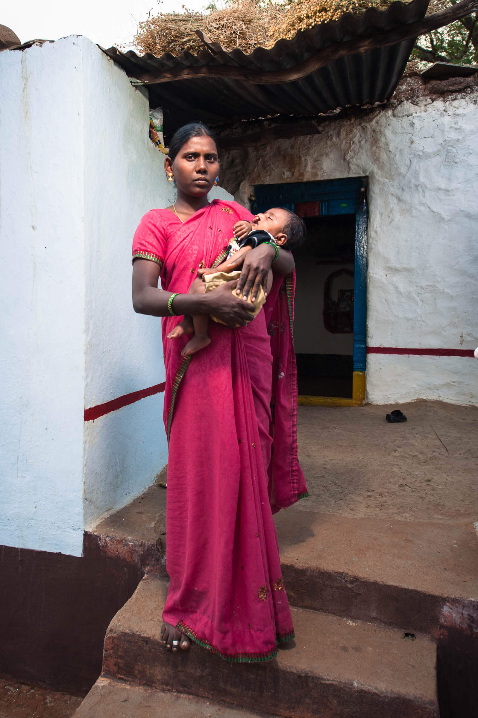Cleft Kind Indien 114